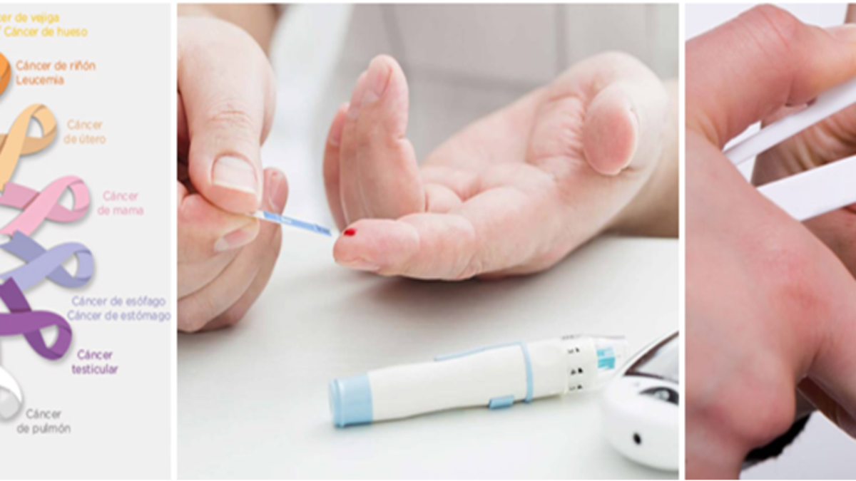 diabetes límite en el carcinoma de ovario