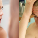 5 tips para controlar el acné en la adolescencia